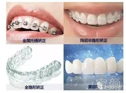 https://img.miyanlife.com/timg/170413/211F1C34-3.jpg