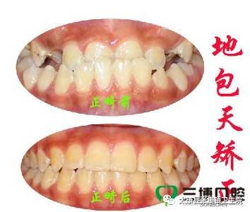 https://img.miyanlife.com/timg/170413/21200B1E-1.jpg