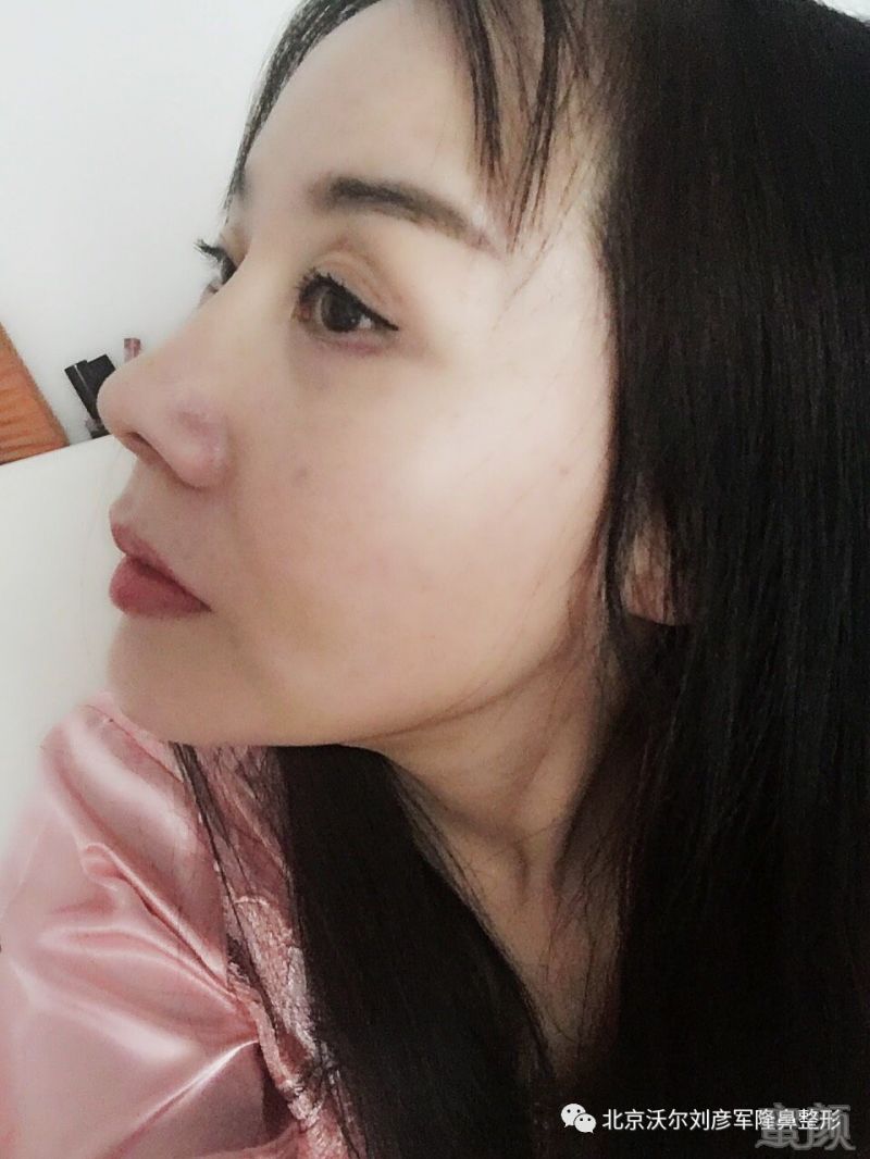 https://img.miyanlife.com/timg/170413/21313H015-7.jpg