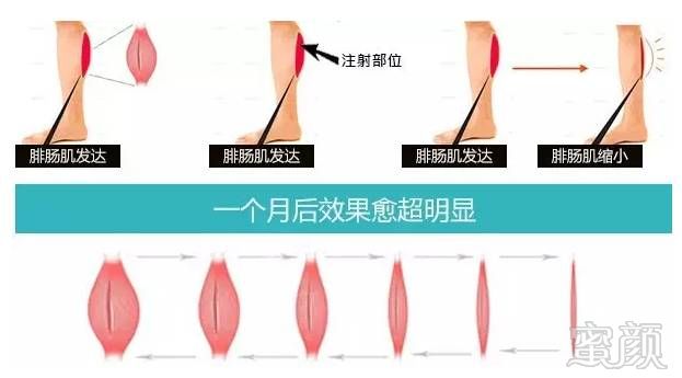 案例图片