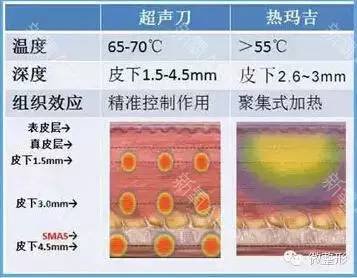 案例图片