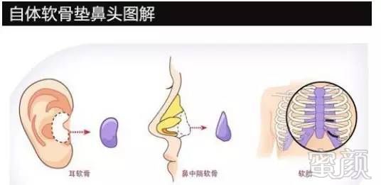 https://img.miyanlife.com/timg/170413/235Q52K9-1.jpg