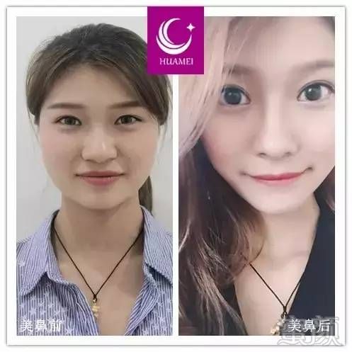 https://img.miyanlife.com/timg/170414/0005443412-4.jpg