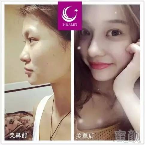 https://img.miyanlife.com/timg/170414/000545G00-5.jpg