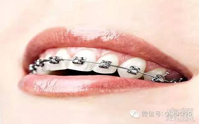 https://img.miyanlife.com/timg/170414/221H63008-4.jpg