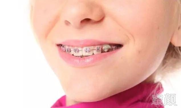 https://img.miyanlife.com/timg/170414/22203KU3-2.jpg