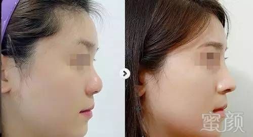 https://img.miyanlife.com/timg/170415/120343F92-1.jpg