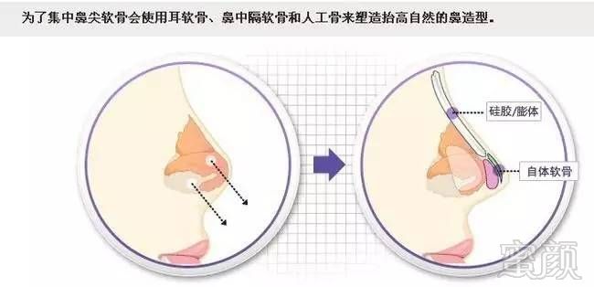 https://img.miyanlife.com/timg/170415/1203454P1-8.jpg