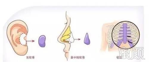 https://img.miyanlife.com/timg/170415/1203454Q7-6.jpg
