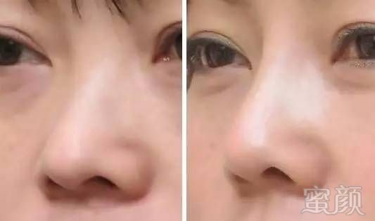 https://img.miyanlife.com/timg/170415/12034A200-10.jpg