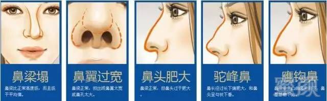https://img.miyanlife.com/timg/170415/12060RQ5-1.jpg