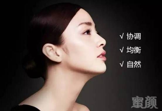 https://img.miyanlife.com/timg/170415/1244235G8-4.jpg