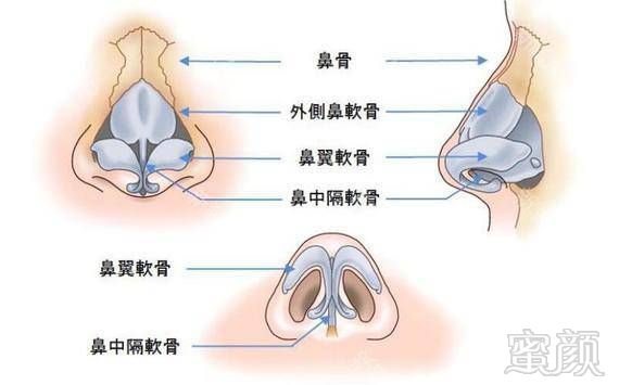 https://img.miyanlife.com/timg/170418/2250494241-1.jpg