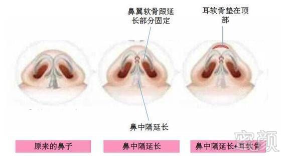 https://img.miyanlife.com/timg/170418/2250496247-2.jpg