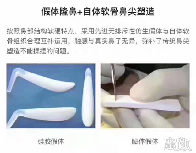 https://img.miyanlife.com/timg/170418/2250505346-4.jpg
