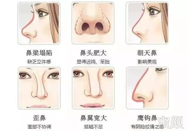 https://img.miyanlife.com/timg/170418/231P52243-1.jpg