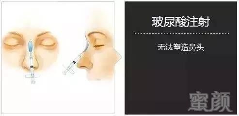 https://img.miyanlife.com/timg/170418/231P645N-4.jpg