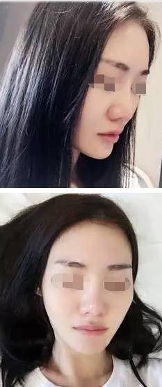 https://img.miyanlife.com/timg/170419/2212316417-0.jpg