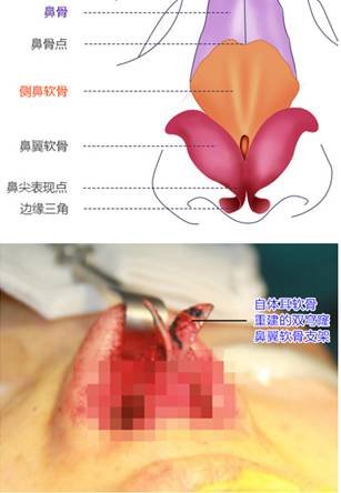 https://img.miyanlife.com/timg/170419/22151125S-12.jpg