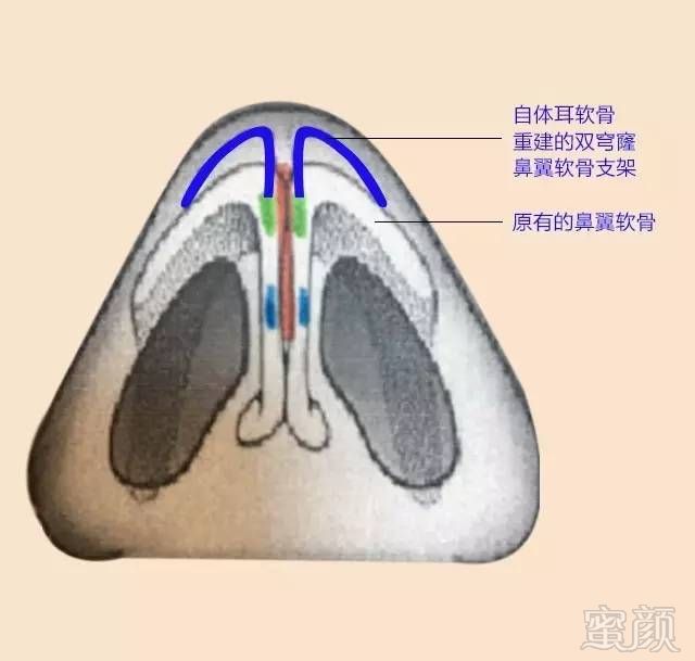 https://img.miyanlife.com/timg/170419/2215115335-13.jpg