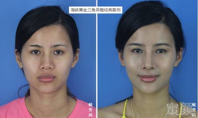 https://img.miyanlife.com/timg/170419/2219103004-4.jpg