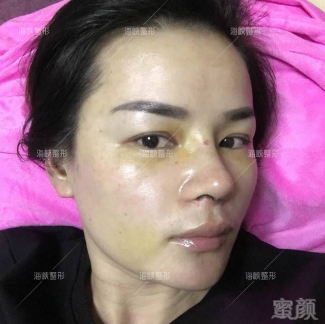 https://img.miyanlife.com/timg/170419/22461464M-11.jpg