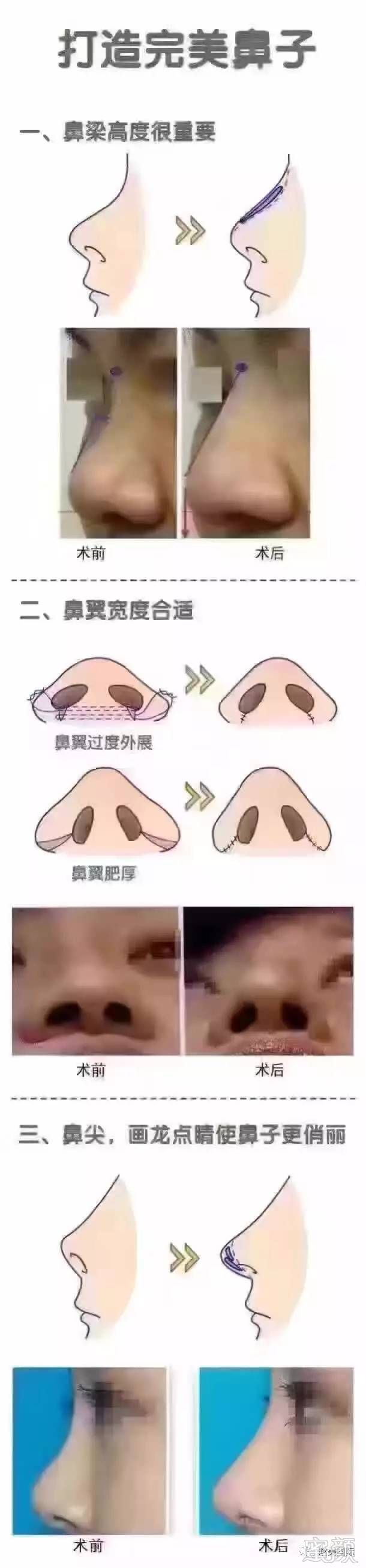 https://img.miyanlife.com/timg/170419/23235HW0-2.jpg