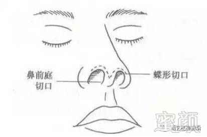 https://img.miyanlife.com/timg/170420/00023H626-4.jpg