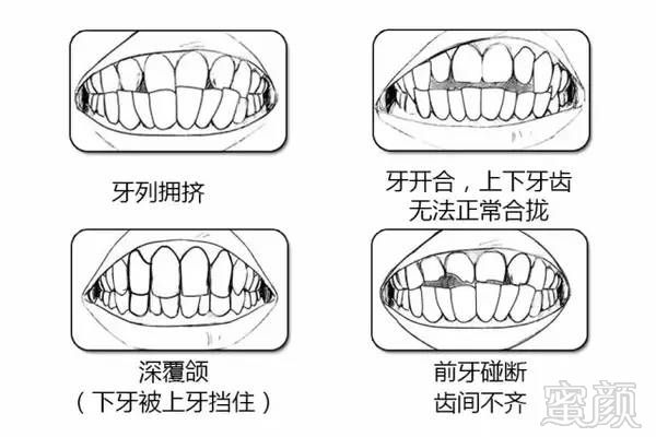 https://img.miyanlife.com/timg/170420/145R4C28-2.jpg