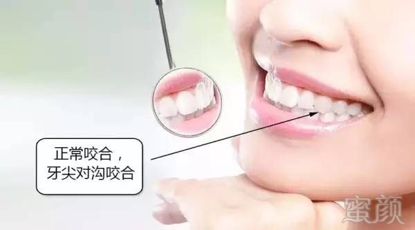 https://img.miyanlife.com/timg/170420/145R51N1-4.jpg