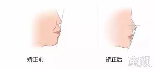 https://img.miyanlife.com/timg/170420/145R5C35-6.jpg