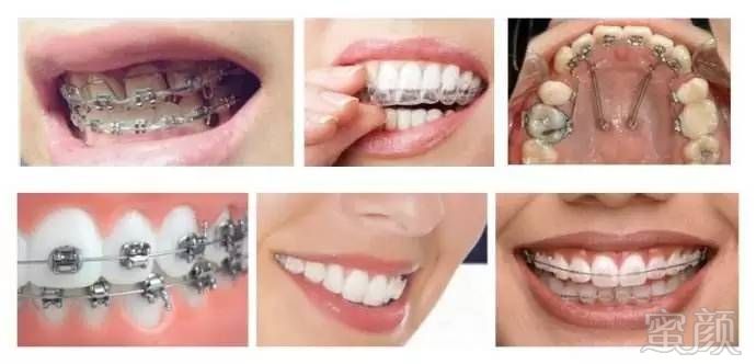 https://img.miyanlife.com/timg/170420/145R63P0-7.jpg