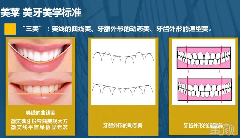 https://img.miyanlife.com/timg/170420/145RG918-11.jpg