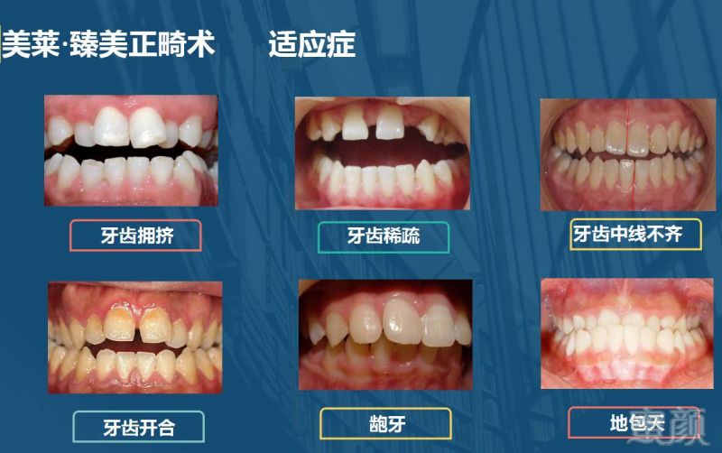 https://img.miyanlife.com/timg/170420/145S04E4-15.jpg