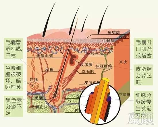 案例图片