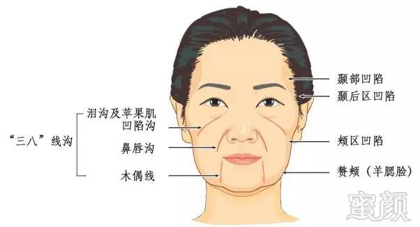 https://img.miyanlife.com/timg/170420/1640491300-2.jpg