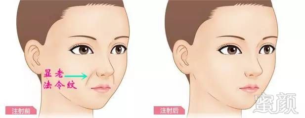 https://img.miyanlife.com/timg/170420/164050I08-6.jpg