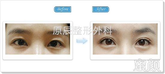 https://img.miyanlife.com/timg/170420/1946163412-2.jpg