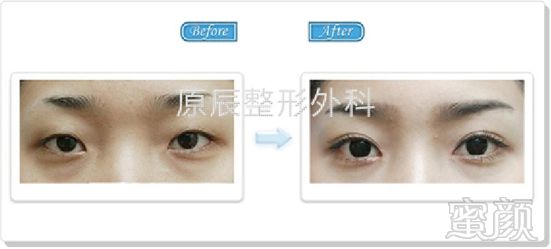 https://img.miyanlife.com/timg/170420/19461L231-3.jpg
