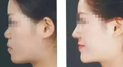 https://img.miyanlife.com/timg/170420/2319443c9-0.jpg