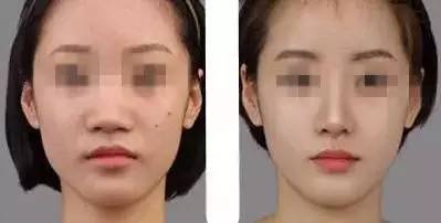 https://img.miyanlife.com/timg/170420/231945N38-4.jpg
