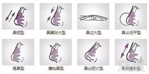 https://img.miyanlife.com/timg/170420/233912E54-5.jpg