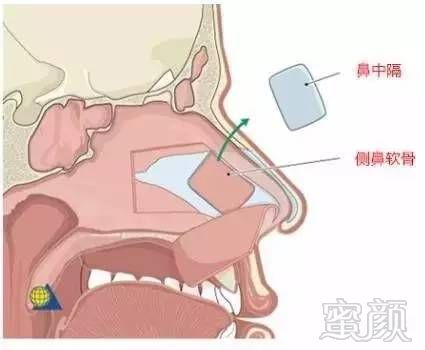 案例图片