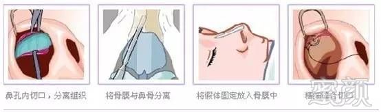 https://img.miyanlife.com/timg/170420/23405649D-11.jpg