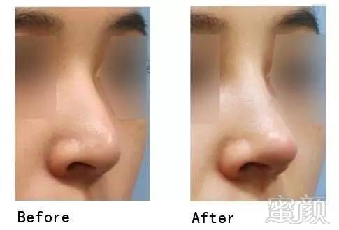 https://img.miyanlife.com/timg/170420/23405IS2-13.jpg