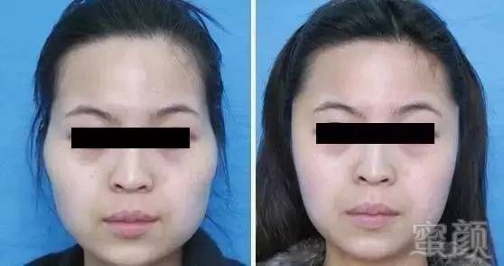 https://img.miyanlife.com/timg/170421/0023292932-9.jpg