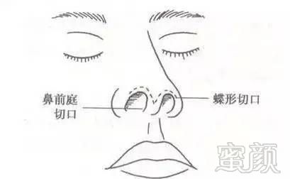 https://img.miyanlife.com/timg/170421/21512L396-4.jpg
