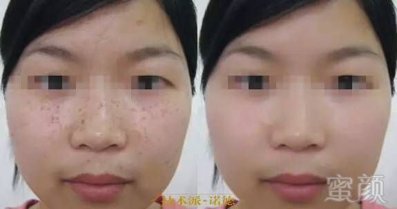 https://img.miyanlife.com/timg/170424/21434C1Z-4.jpg