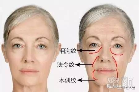 https://img.miyanlife.com/timg/170425/2223025047-4.jpg