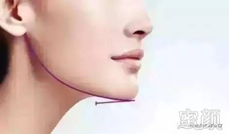 https://img.miyanlife.com/timg/170425/2223035G5-7.jpg